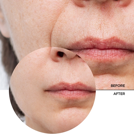 Revox B77 Just Peptides 10% sérum visage raffermissant avec des peptides