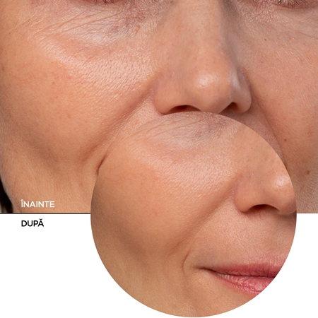Revox B77 JUST Coenzyme Q10 ser facial anti-îmbătrânire cu coenzima Q10