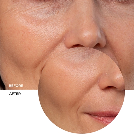Revox B77 Just Coenzyme Q10 serum proti staranju kože s koencimom Q10