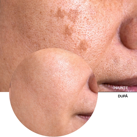 Revox B77 Just Vitamin C 20% ser antioxidant cu vitamina C