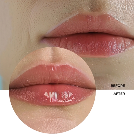 Revox B77 Lip Filler Hyaluronic Acid drėkinamasis lūpų balzamas maksimaliai apimčiai
