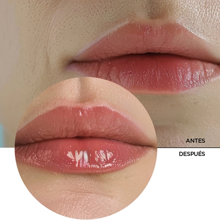 Revox B77 Lip Filler Hyaluronic Acid bálsamo hidratante para labios para aumentar volumen