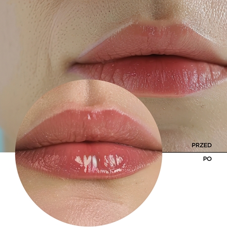 Revox B77 Lip Filler Hyaluronic Acid nawilżający balsam do ust do zwiększenia objętości