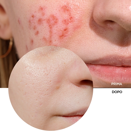 Revox B77 JUST Vitamin C 2% Suspension crema idratante illuminante per viso e collo