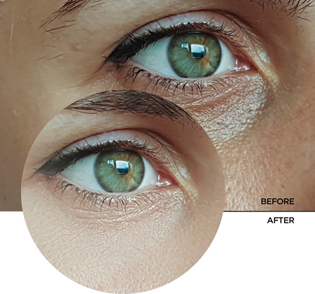 Revox B77 JUST Rose Water Avocado Oil Eye Care hydrating fluid for eye area to treat dark circles