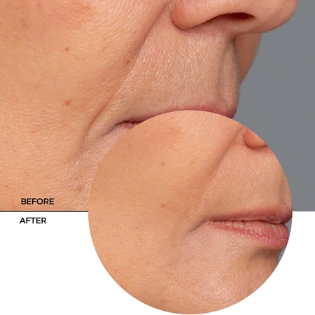 Revox B77 Retinol Serum sérum antirrugas com retinol