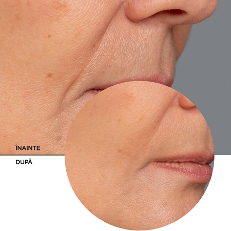 Revox B77 Retinol Serum ser antirid cu retinol