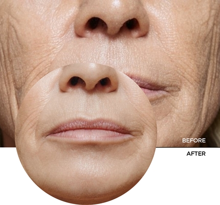 Revox B77 Retinol Cream dnevna krema proti gubam SPF 20