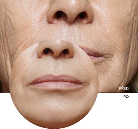 Revox B77 Retinol Cream denní protivráskový krém SPF 20