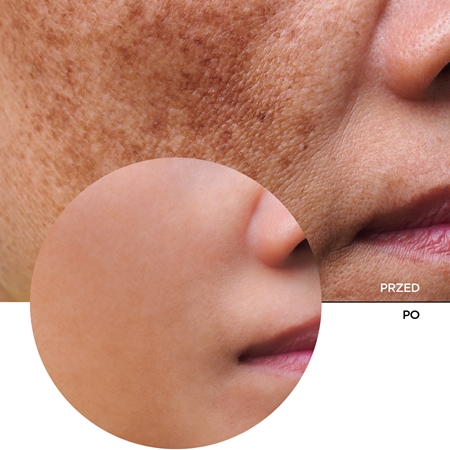 Revox B77 JUST Mandelic Acid 10% + HA serum wygładzające z kwasem migdałowym