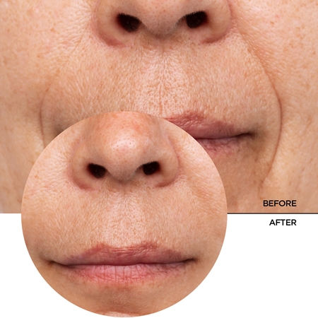 Revox B77 Just Retinol In Squalane sérum au rétinol anti-rides visage et cou