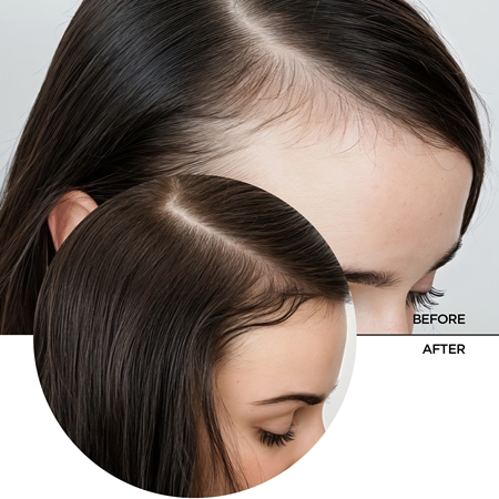 Revox B77 JUST Multi Peptides for Hair Serum für die Erneuerung der Haardichte