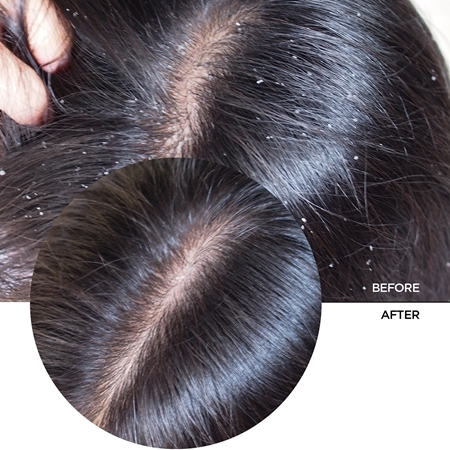 Revox B77 JUST Hyaluronic Acid 2% for Hair sérum hydratant cheveux et cuir chevelu