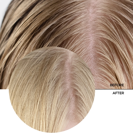 Revox B77 JUST Salicylic Acid 2% sérum purifiant en profondeur cuir chevelu