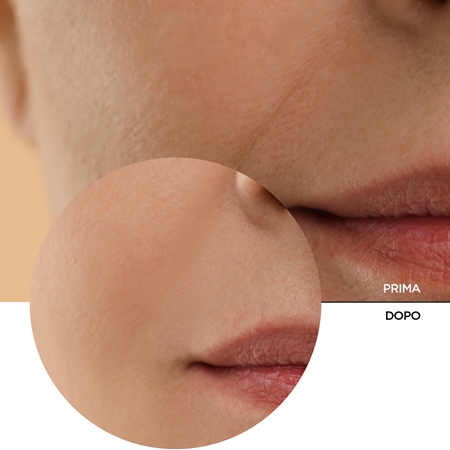 Revox B77 JUST Retinol lozione tonica per ringiovanire la pelle