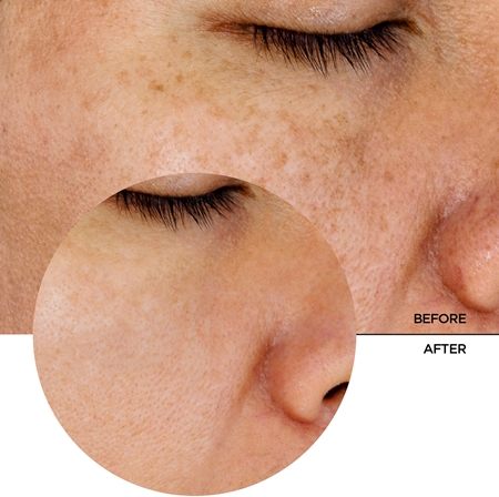 Revox B77 Just Glycolic Acid 7% lotion tonique exfoliante douce