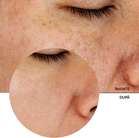 Revox B77 JUST Glycolic Acid 7% tonic exfoliant delicat
