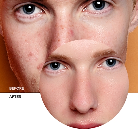 Revox B77 Zitcare AHA BHA PHA Resurfacing Cream изглаждащ нощен крем