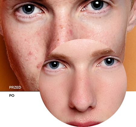 Revox B77 Zitcare AHA BHA PHA Resurfacing Cream wygładzający krem na noc