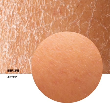 Revox B77 Skintreats Biotic Regenerating Filling Balm регенериращ балсам за подхранване и хидратация
