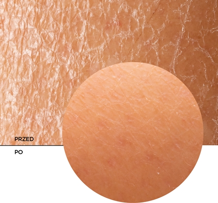 Revox B77 Skintreats Biotic Regenerating Filling Balm balsam regenerujący odżywienie i nawilżenie