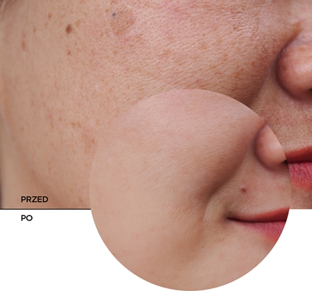 Revox B77 Skintreats Biotic Revitalising Radiance Cream krem rewitalizujący z efektem rozświetlającym