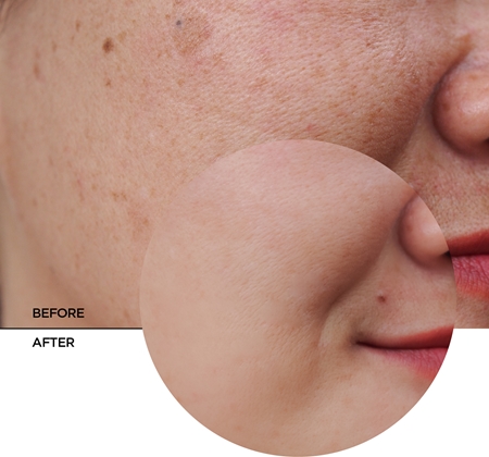 Revox B77 Skintreats Biotic Revitalising Radiance Cream ревитализиращ крем за озаряване на лицето
