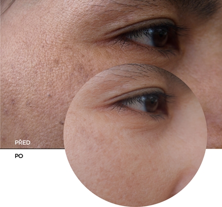 Revox B77 Skintreats Biotic Rehydrating Plumping Jelly hydratační pleťový gel