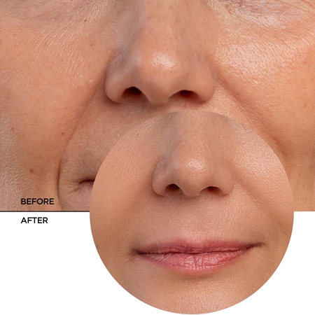 Revox B77 JUST Retinal anti-ageing serum