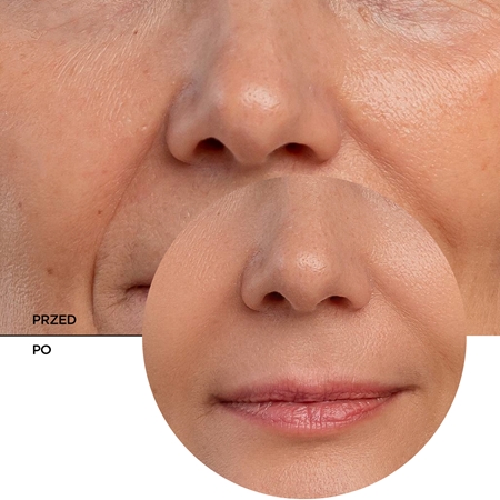 Revox B77 JUST Retinal serum przeciw starzeniu się skóry