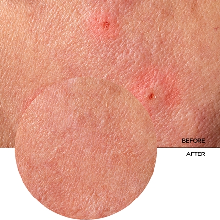 Revox B77 JUST Provitamin B5 and Centella baume hydratant pour apaiser la peau