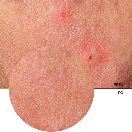 Revox B77 JUST Provitamin B5 and Centella hydratační balzám pro zklidnění pleti