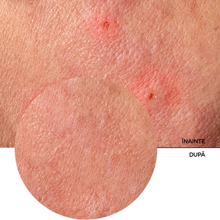 Revox B77 JUST Provitamin B5 and Centella ro balsam hidratant pentru netezirea pielii