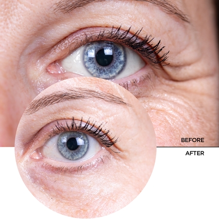 Revox B77 JUST Multi-Peptide Mjukgörande serum för ögonen