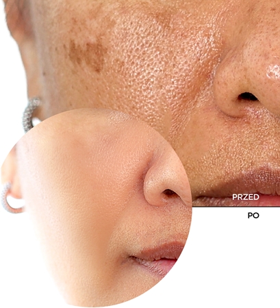 Revox B77 Skintreats Biotic Resurfacing Activator serum wygładzająco-złuszczające z efektem rozświetlającym