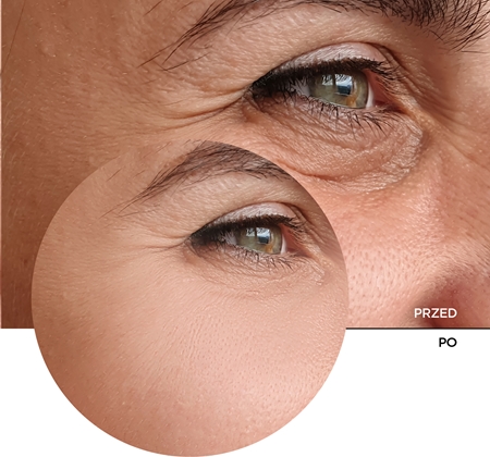 Revox B77 JUST Retinal 0.2% Fluid fluid multi korygujący przeciw starzeniu się skóry