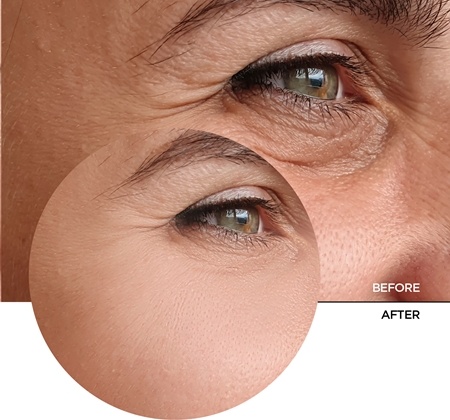 Revox B77 JUST Retinal 0.2% Fluid мултикоригиращ флуид против стареене на кожата