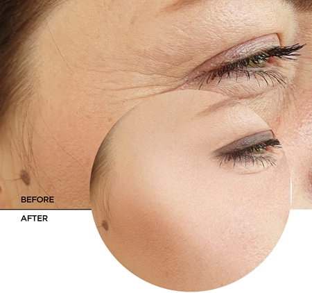 Revox B77 JUST Retinol 0.3% + Niacinamide 5% hydratačná vyhladzujúca emulzia proti starnutiu pleti