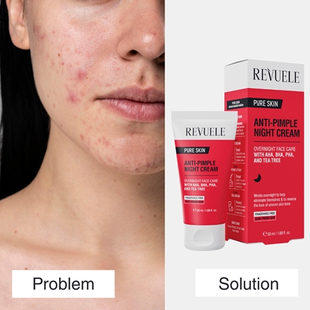 Revuele Pure Skin Anti-Pimple crème de nuit anti-acné