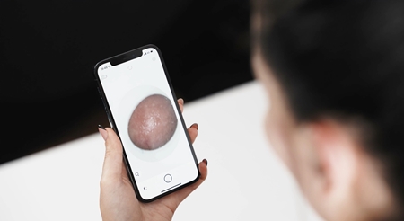 RIO Pore Perfection Pro aspirateur visage