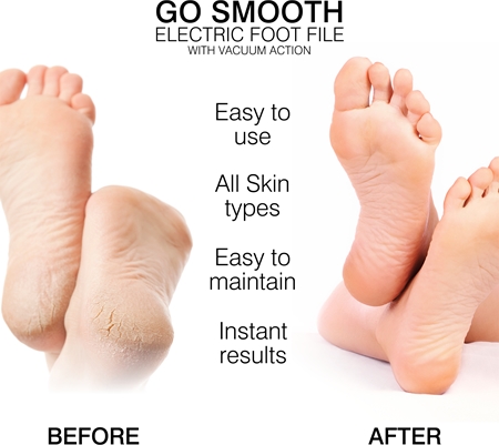 RIO Go Smooth Vacuum Action elektrický pilník na chodidla