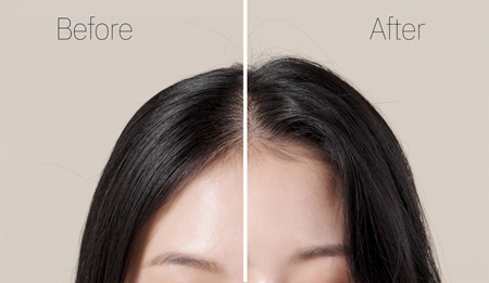RYO Root:Gen Hair Loss Care Shampoo Strengthening Shampoo Against Hair Fall for women