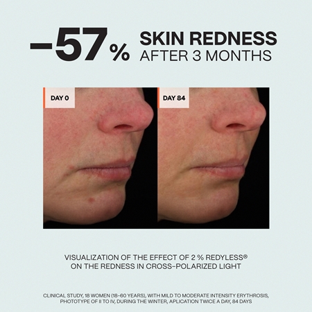 Saffee SensiDerm Soothing Relief Cream успокояващ крем за суха и чувствителна кожа