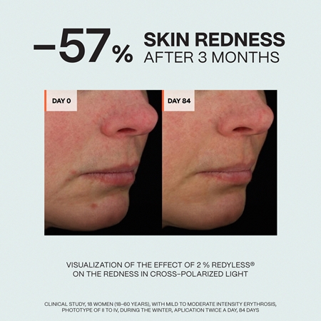 Saffee SensiDerm Soothing Relief Cream rauhoittava voide kuivalle ja herkälle iholle