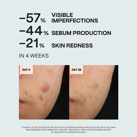 Saffee ClearDerm Day & Night Care Set set za problematično kožo