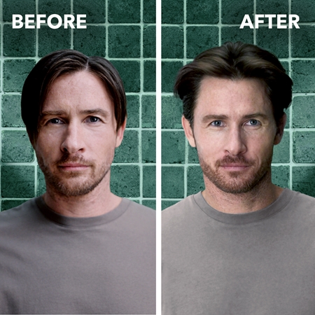 Schwarzkopf Schauma Hair Booster Koffein Tonikum für feines oder schütteres Haar