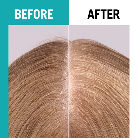 Schwarzkopf Gliss Scalp Balance Gentle Shampoo for Everyday Use