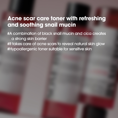 Some By Mi Snail Truecica Miracle Repair Toner elvyttävä ja puhdistava hoitovesi herkälle iholle