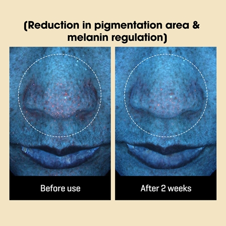 Some By Mi Yuja Niacin Anti Blemish Daily Mask Uppljusande arkmask för ansiktet för jämn hudton