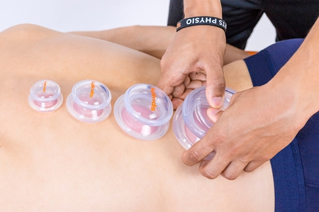 Spophy Cupping Set sada silikonových baněk